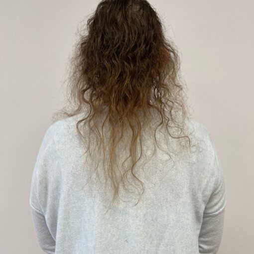 Eine Frau mit ausgedünnten braunen Haaren steht mit dem Rücken zum Betrachter